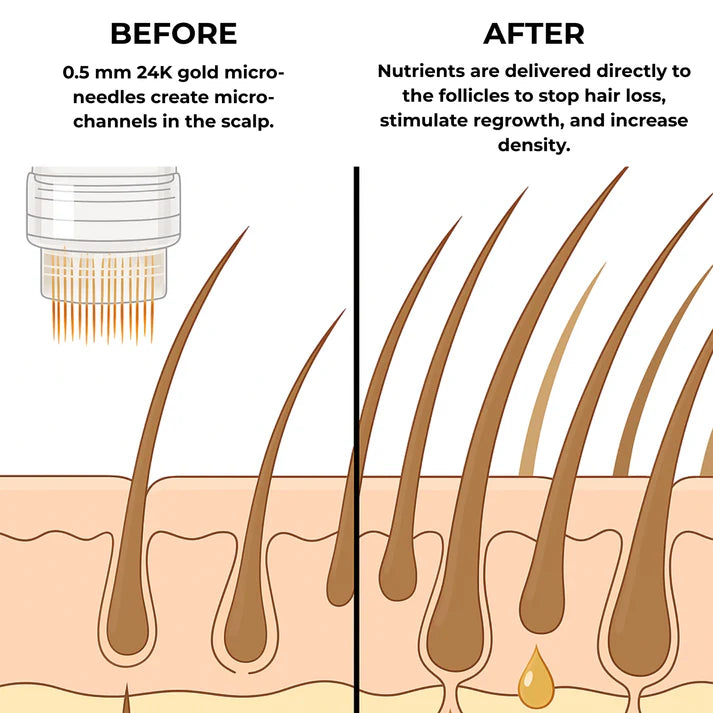 MICRO-INFUSE® Hair Technology – For Men